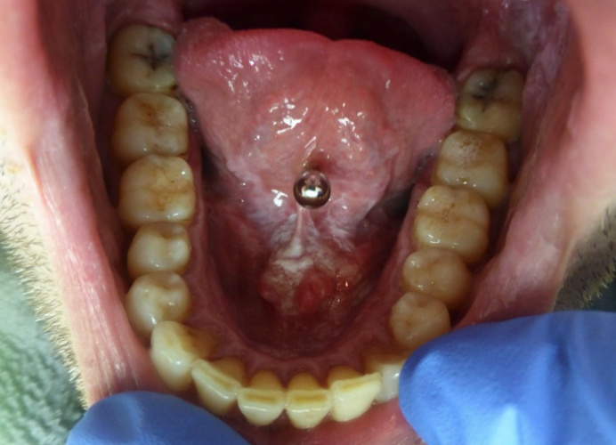 medicina oral El Prat de Llobregat