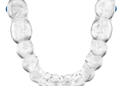 Ortodoncia clínica dental el Prat
